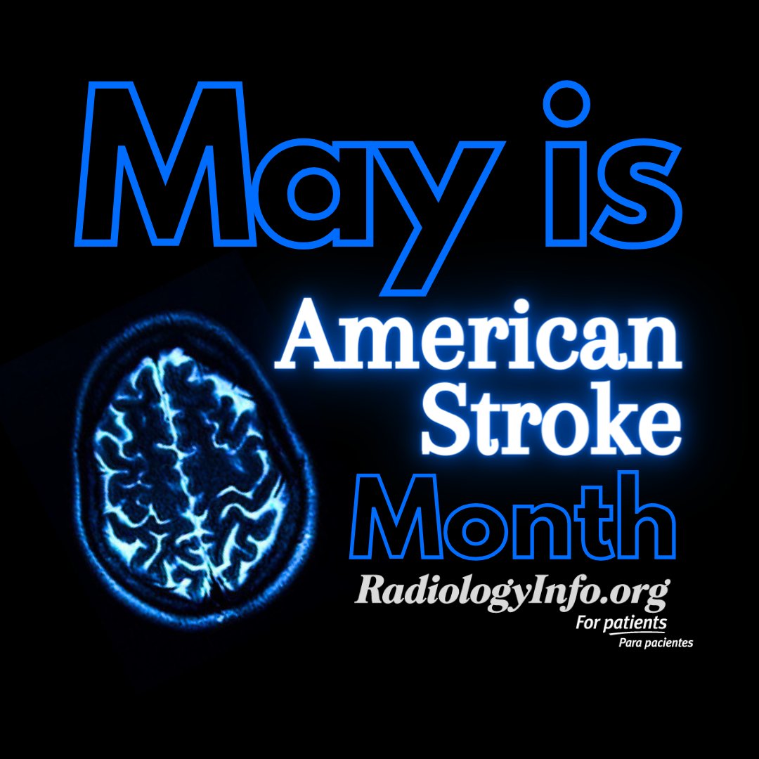 Signs of #Stroke may include sudden numbness or weakness in the face, arm, or leg. Other warning signs include trouble seeing, walking, or speaking. Stroke is treatable when recognized quickly. Learn more at bit.ly/3ns9C7e #StrokeMonth #RadiologyInfo