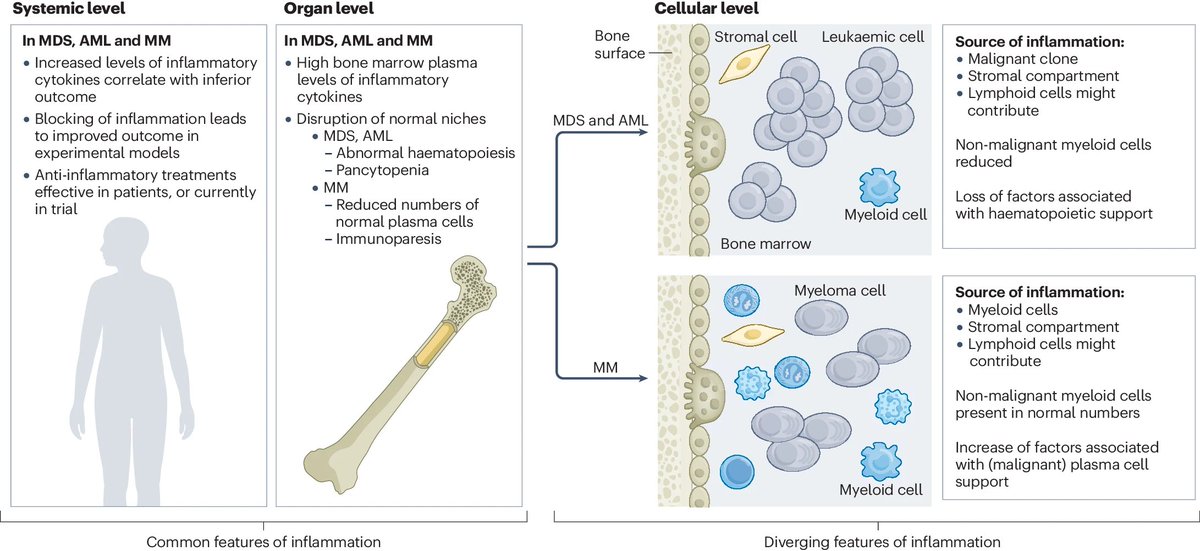 Bone marrow #inflammation in haematological malignancies
nature.com/articles/s4157…
#MDSsm #MPNsm #leusm #MMsm