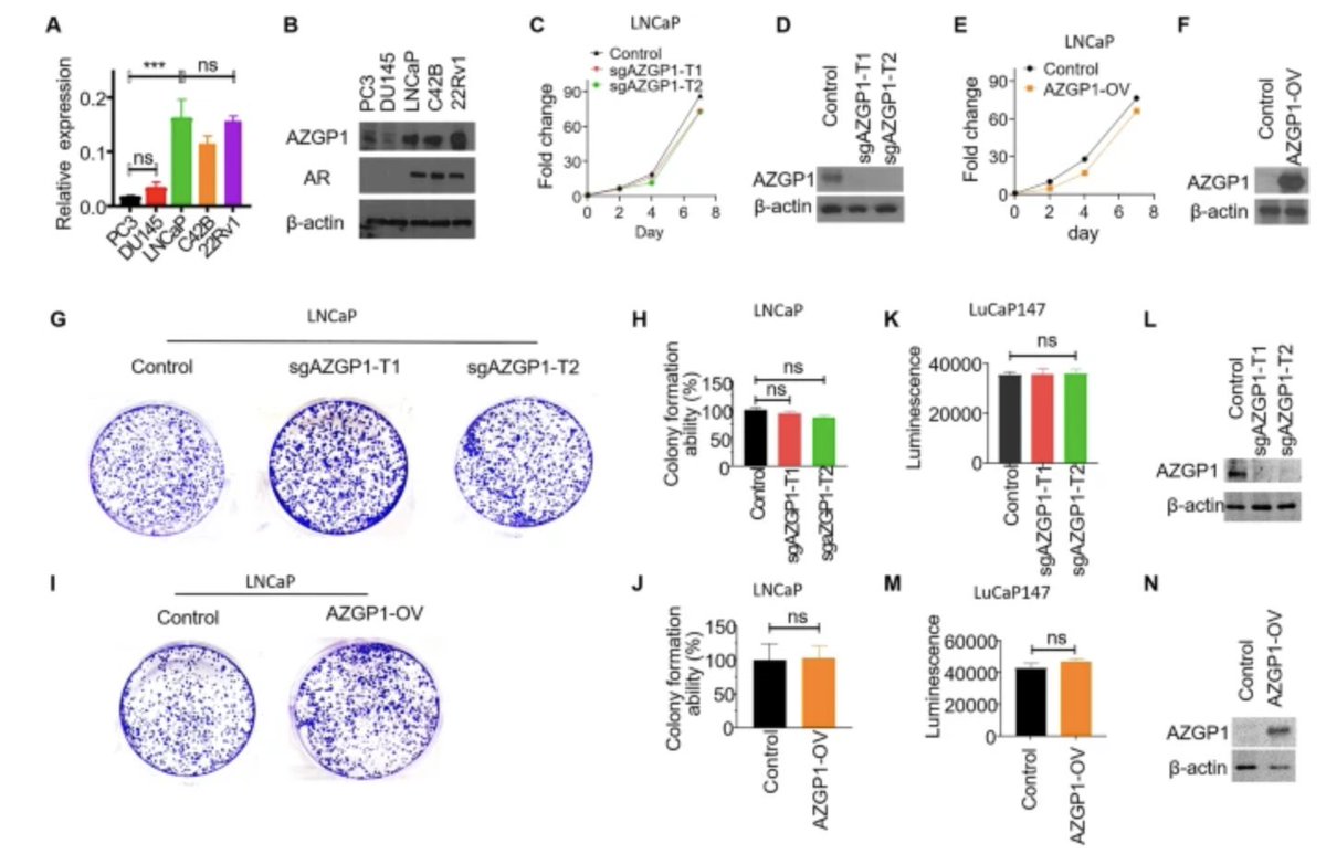 SCI member James Brooks & others found AZGP1 is a negative regulator of angiogenesis, such that loss of AZGP1 promotes angiogenesis in #ProstateCancer. bit.ly/3JImWQF