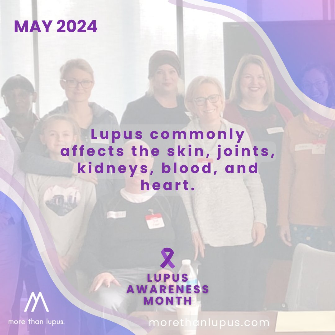 DYK: Lupus commonly affects the skin, joints, kidneys, blood, and heart. But many other parts of the body are affected as well. #KnowMore #MoreAtMore #LAM24 #lupuswawareness #healthliteracy #ChronicillnessAwareness #SLE #lupus