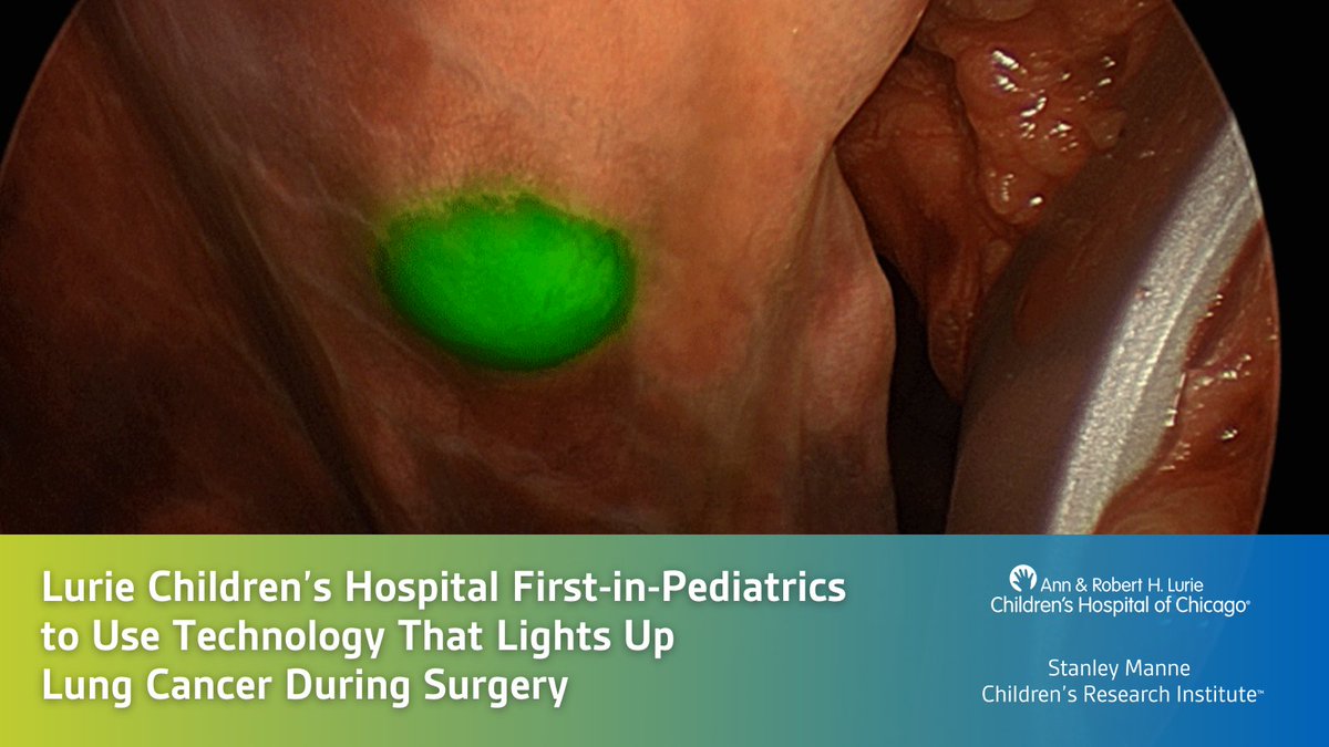 .@Luriechildrens is first #pediatric hospital to use novel fluorescent agent CYTALUX which allows surgeons to better see cancerous cells during lung surgery. luriechildrens.org/en/news-storie… @sethgoldsteinmd @TimothyLautz @NUFeinbergMed #research