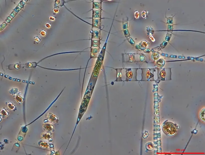 Glittering diatoms, magnified 200X