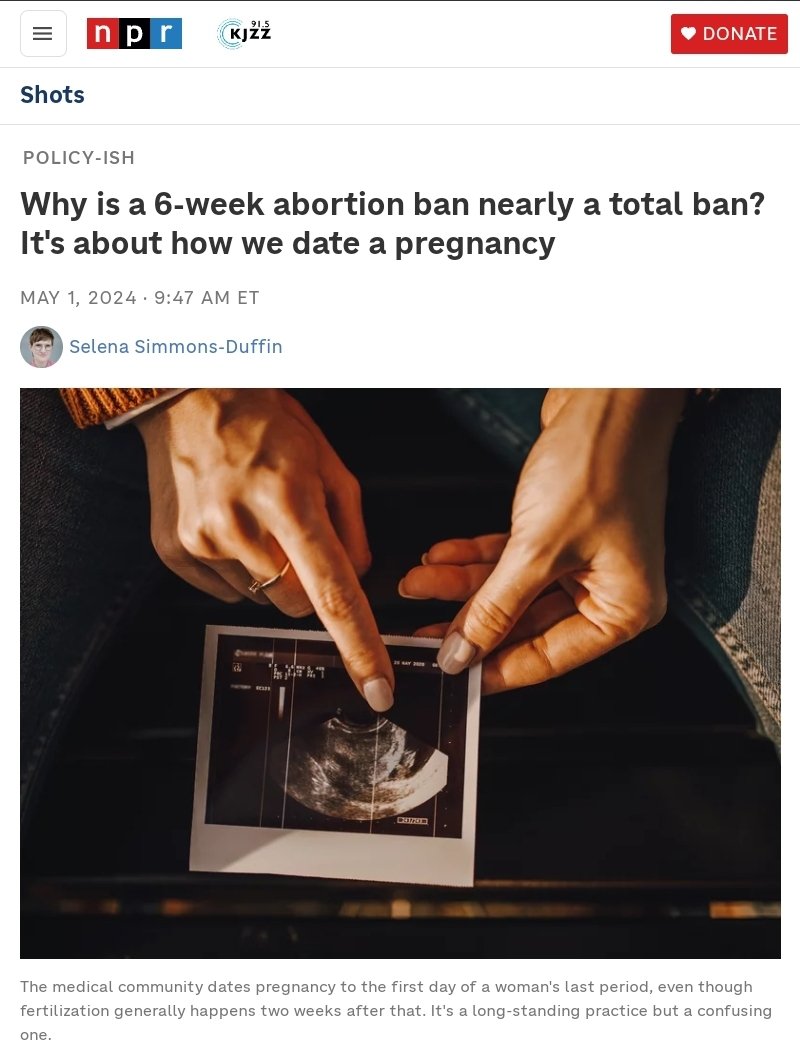 Florida's 6 week ban starts today, which is often not even enough time to know a pregnancy exists. I hope you're all paying attention to what's happening in these garbage red states ⚠️ . npr.org/sections/healt…