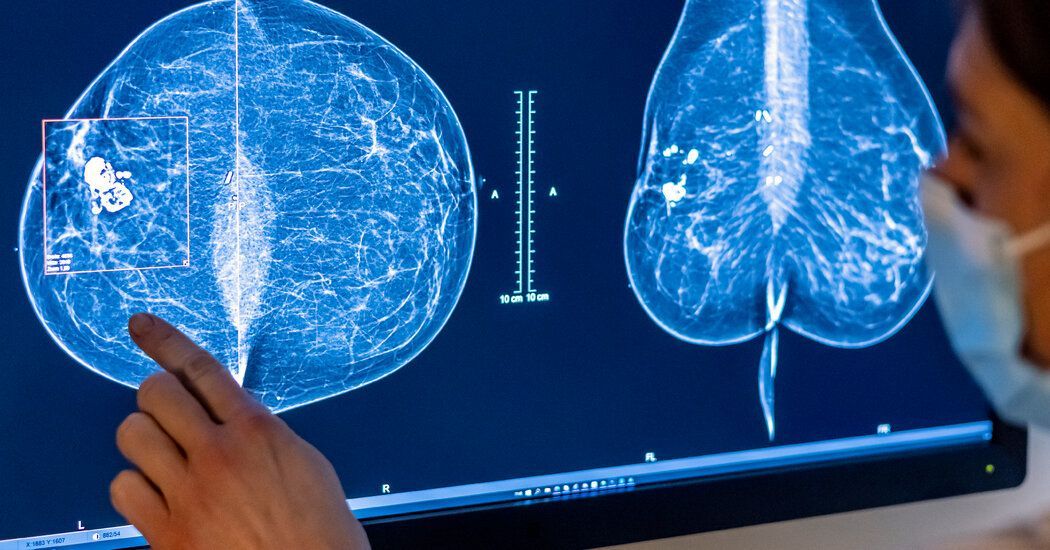 In Reversal, Expert Panel Recommends Breast Cancer Screening at 40 buff.ly/3UHpyEw