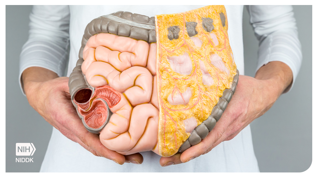 Although you may be embarrassed to talk to your doctor about bowel control problems, your doctor will not be shocked or surprised. Check out #HealthyMoments: niddk.nih.gov/health-informa…

#NIDDK