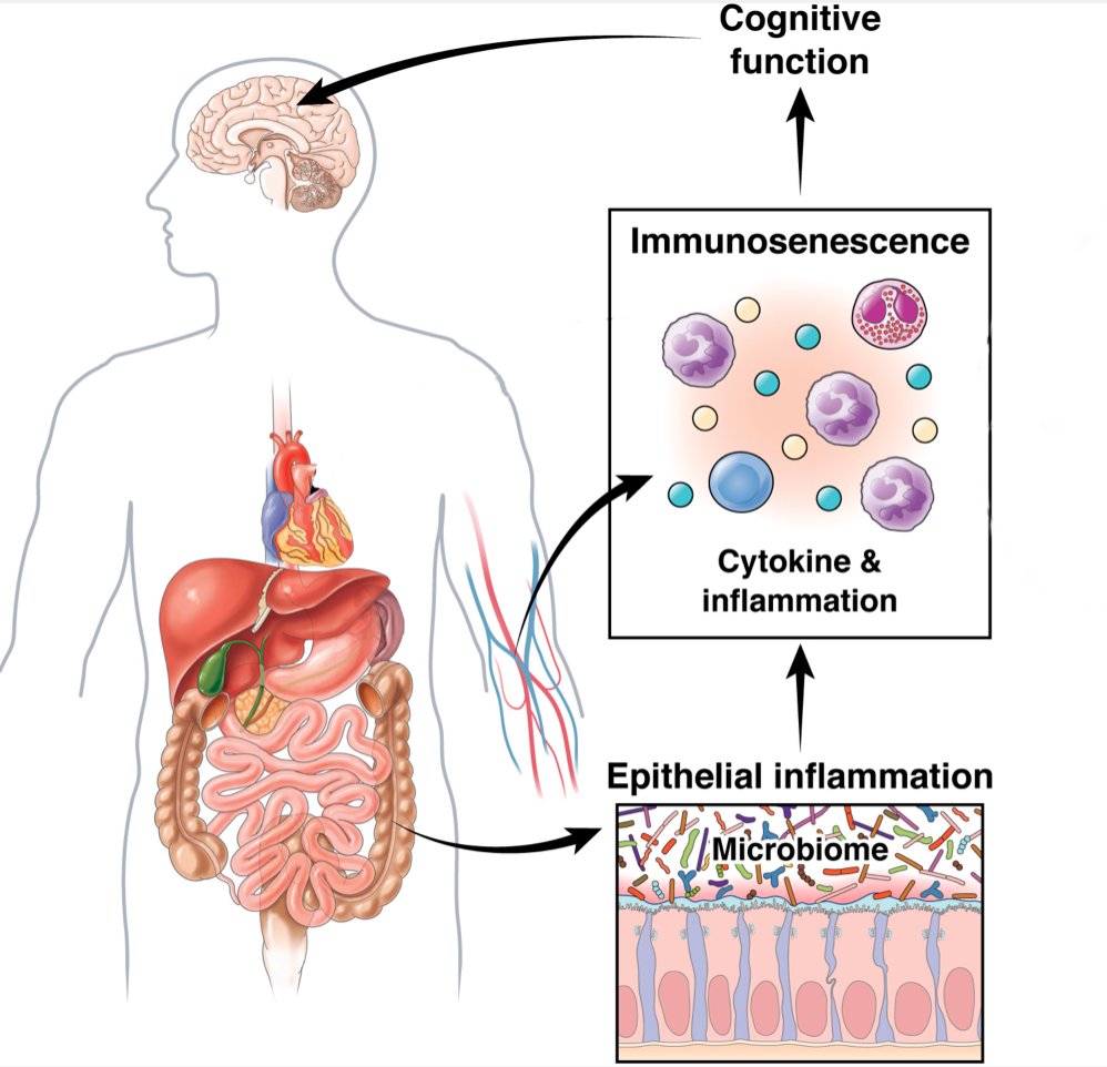 5. Inflammation in the gut can cause brain fog, depression, and anxiety.

Inflammation in the gut leads to inflammation throughout the body, affecting the brain.

The gut and the brain evolved together and are interconnected.

A healthier gut equals a healthier brain.