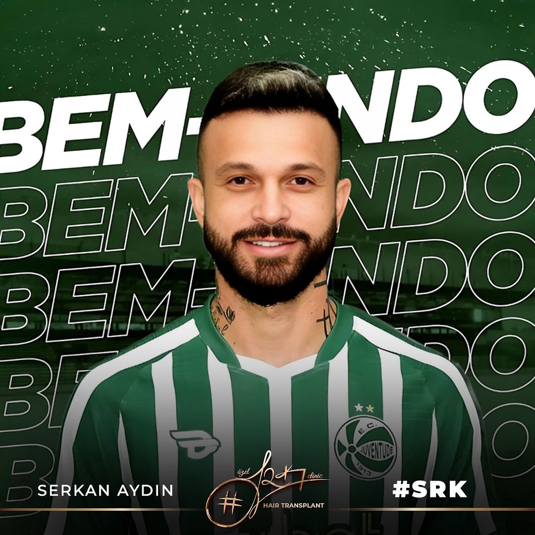 Brazilian Football Player Rick Boldrin's Result 🎨🧑‍🎨

Natural Hairline Restoration with DHI Method and Beard Transplant Together 😎

Contact us Now for a Free Hair Analysis!

#serkanaydin #maximumgrafts #hairtransplant #beardtransplant #stemcell #prp #haartransplant #Stammzellen