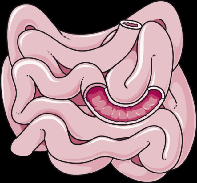 What do we know about covid-19’s effects on the gut? buff.ly/3y2xPdC @kathsci2601