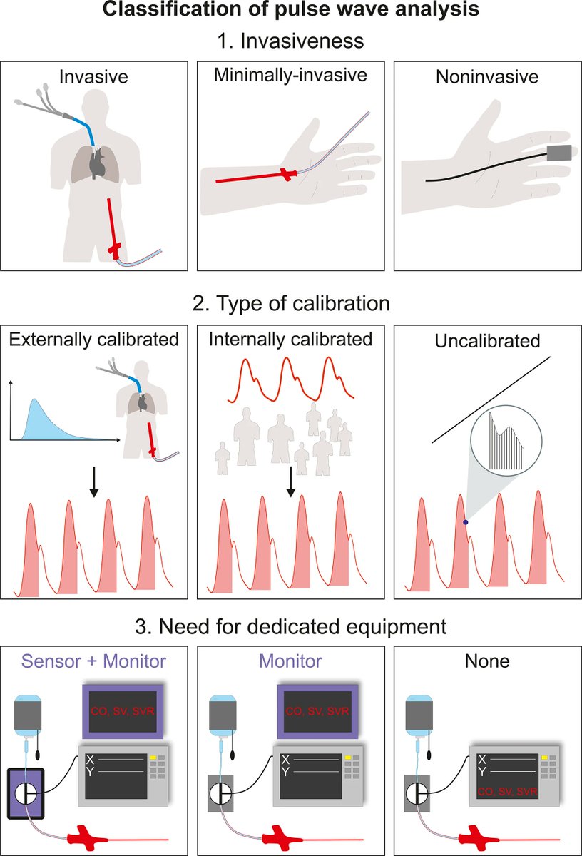 🏥💓 During surgery, monitoring HR, BP , CVP, and more is crucial to maintain organ perfusion and improve outcomes. Explore the evolution, current techniques, and future of hemodynamic monitoring in the work by K Kouz, @MichardFrederic @BerndSaugel 🚀🔬 link.springer.com/article/10.100…