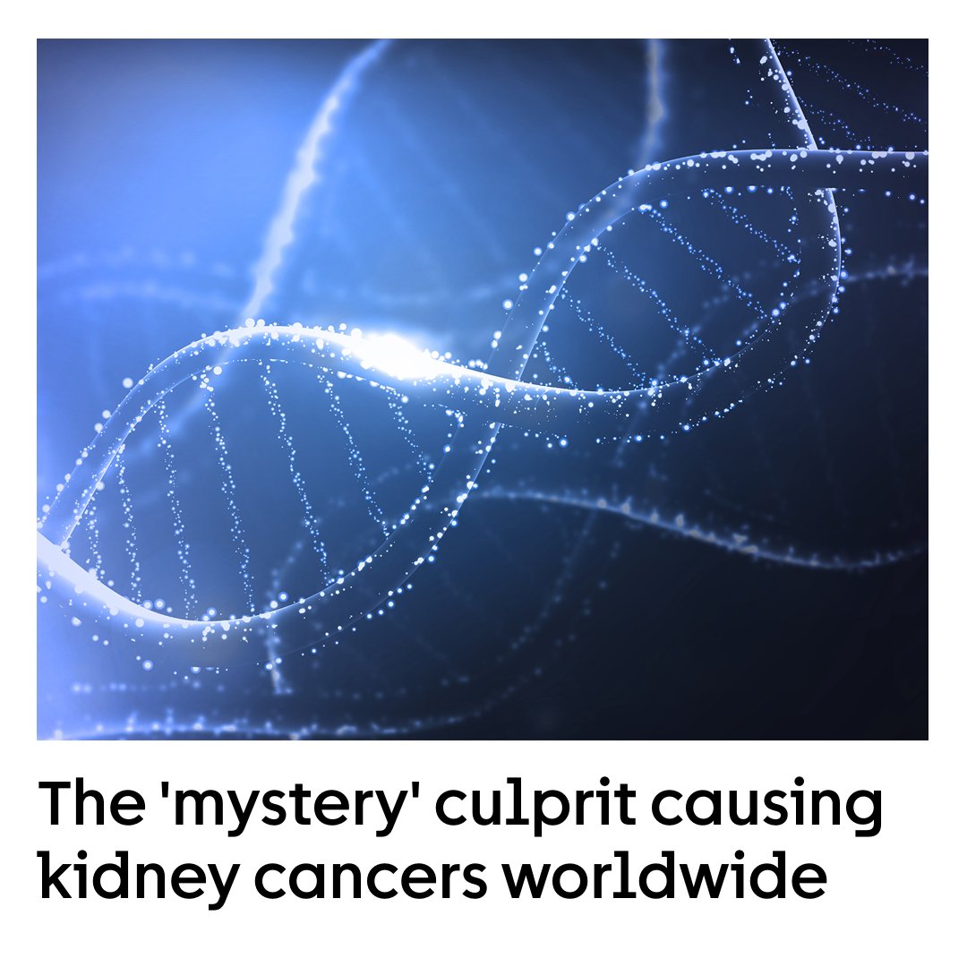 BREAKING NEWS 📣 @CancerGrand team Mutographs has uncovered a DNA 'fingerprint' that could help identify a major cause of kidney cancer. Tracking down the culprit may be the key to helping prevent some people from developing the disease. Read more: cruk.ink/4bgfo3k