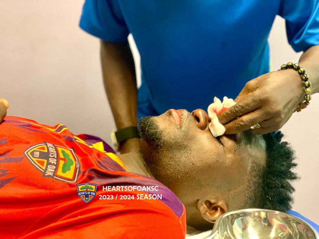 🔴🟡🔵 || Ghana Premier League Update on Otanga. The medical teams are attending to Otanga. He had a cut from the initial collision and it's been stitched. Further update will be given in due course. AHOSC ️0️⃣ - 0️⃣ Accra Lions #AHOSC #PositiveEnergy #StarLife #Phobia4life