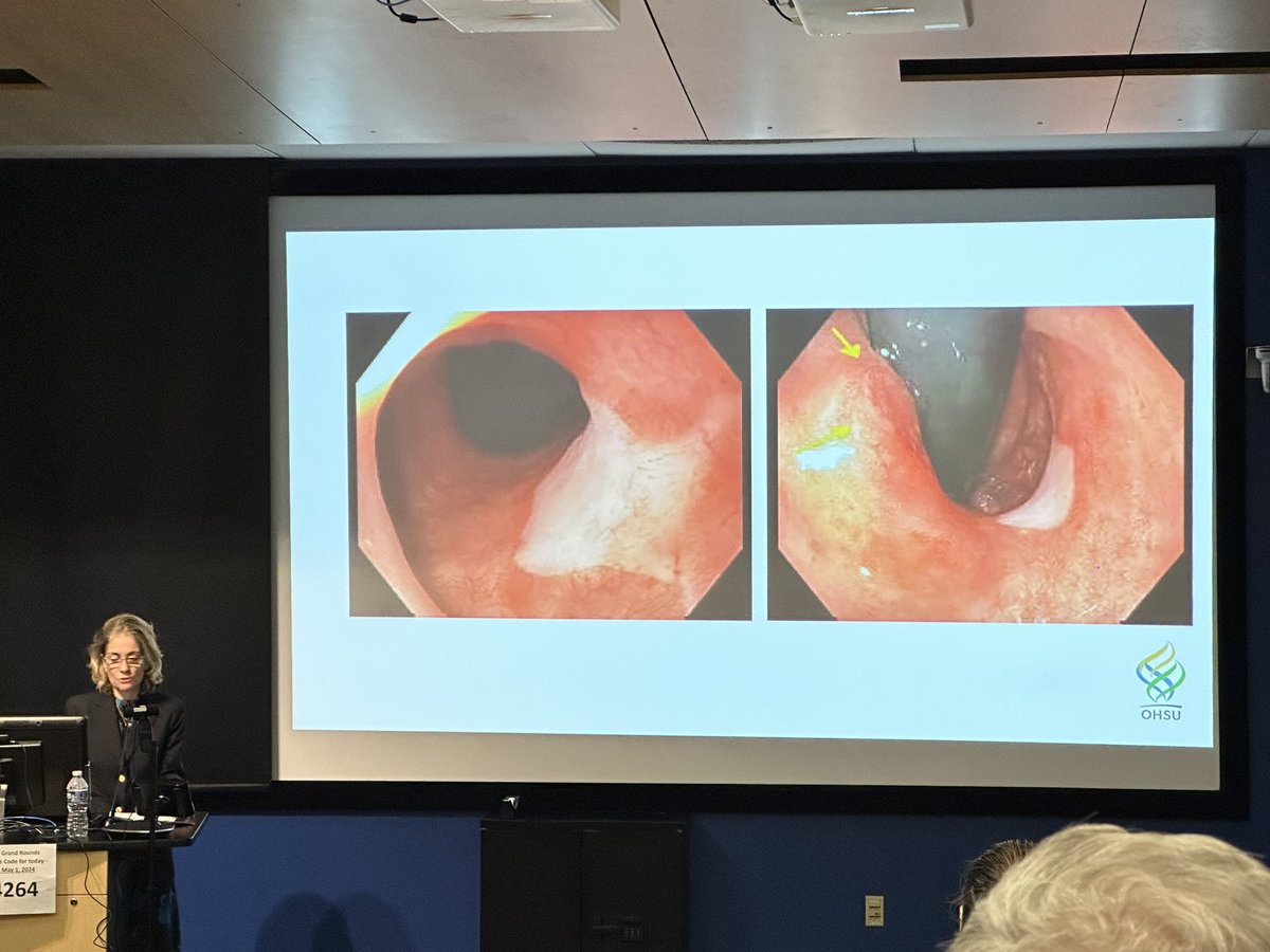 Meghan Good (@meghanlgoodmd) on Twitter photo Excellent talk at Grand Rounds today by Dr. Tsikitis on the advancements in treatment of rectal cancer! What a privilege to have <a href="/tsikitis/">V. Liana Tsikitis</a> come and speak today! <a href="/UofAZSurgery/">University of Arizona Department of Surgery</a> Excellent talk at Grand Rounds today by Dr. Tsikitis on the advancements in treatment of rectal cancer! What a privilege to have <a href="/tsikitis/">V. Liana Tsikitis</a> come and speak today! <a href="/UofAZSurgery/">University of Arizona Department of Surgery</a>