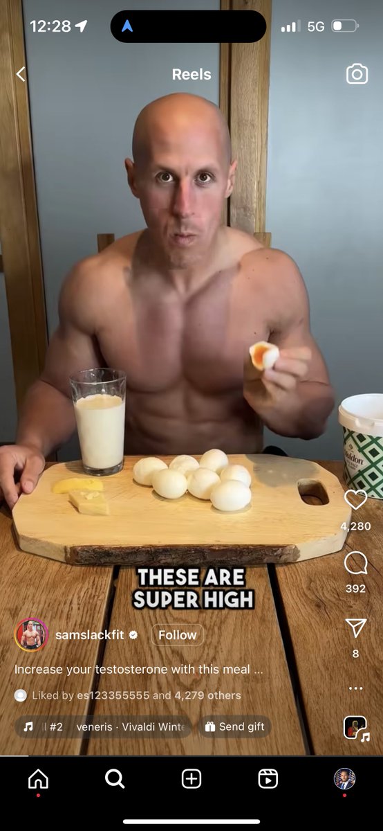 One of the side effects of vitamin A toxicity is balding and thinning hair 

This guys video is called how to raise testosterone 

He’s got milk, eggs, butter and cheese 

This is not the way 

No hair anywhere looks like he might have alopecia 

Most likely is on steroids as…