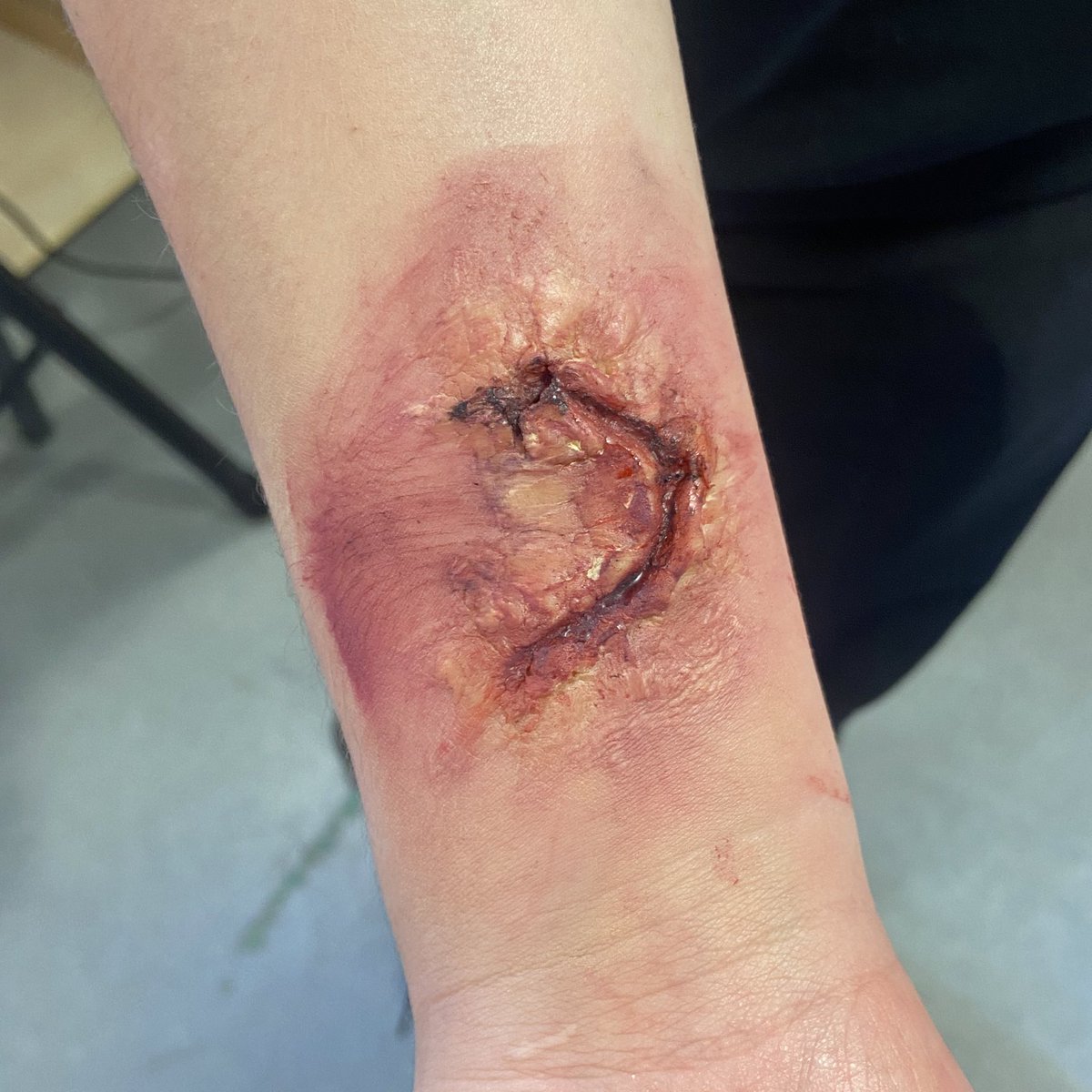 S3 moved on from last weeks bruises to create wounds this week! Fab work and focus! 🎭🙌🏼 #sfxmakeup #dramateacher #pedagoo