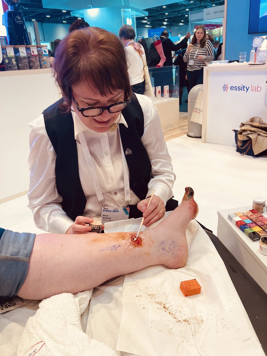 Great day creating my fake wounds for education assessment & management @EWMAwound @essity #EWMA2024 #Tissueviability tomorrow & Friday stand G20 for more !