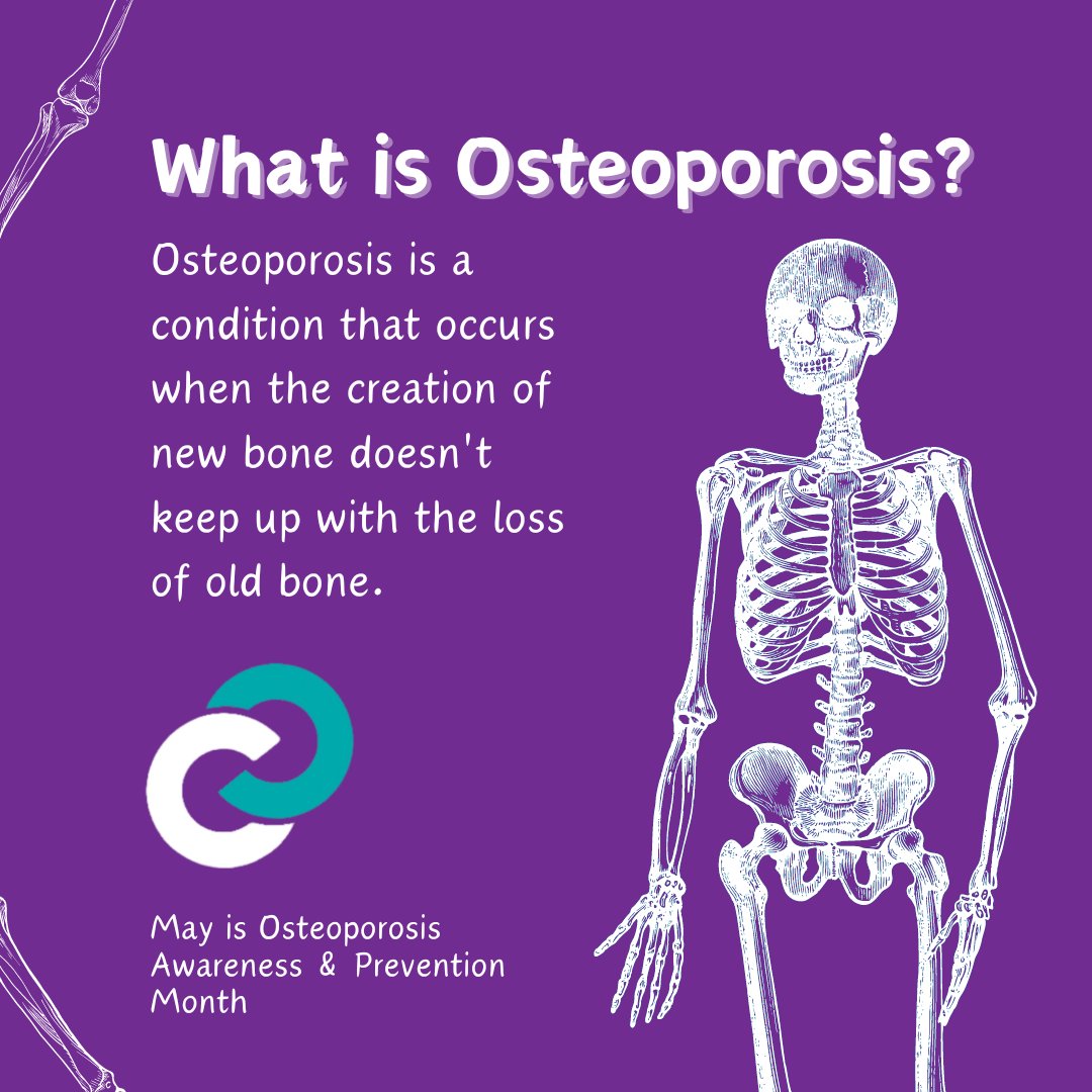 Have you ever asked yourself when the first time osteoporosis was discovered? Historians discovered 4,000-year-old mummies with ‘Dowager’s hump,’ a common sign of osteoporosis — the first time that bones with holes have been discovered. #osteoporosis #bones #bonehealth