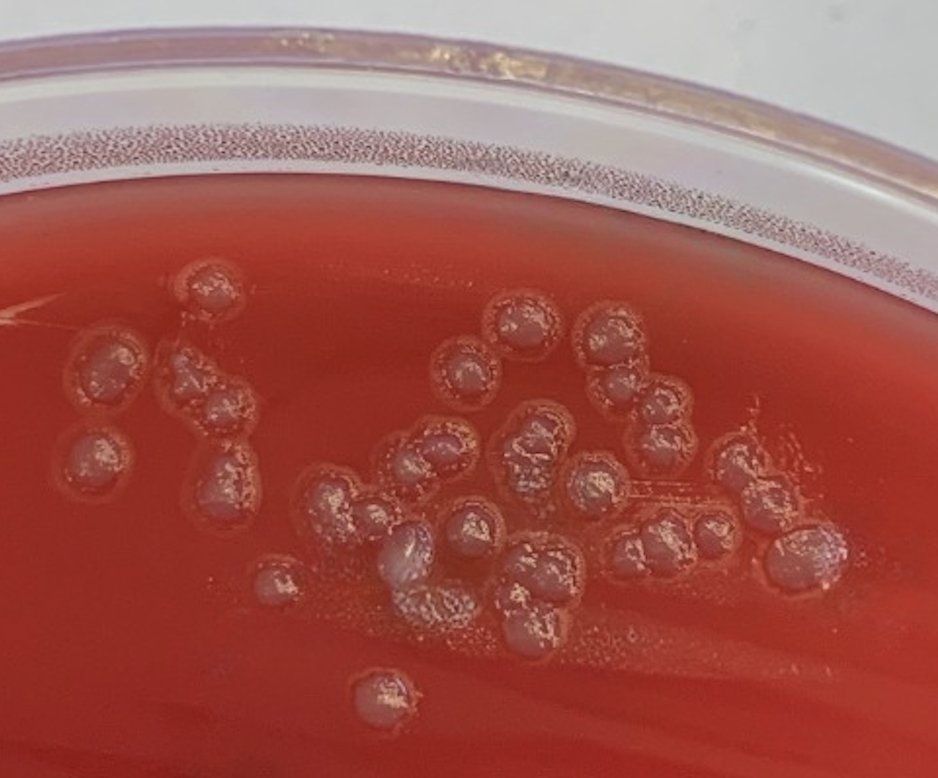 Eikenella corrodens en placa de agar CNA.
Paciente con osteonecrosis mandibular.