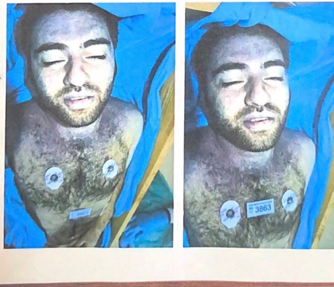 Münevver Karabulut'u öldüren Cem Garipoğlu'nun otopsi görüntüleri paylaşıldı