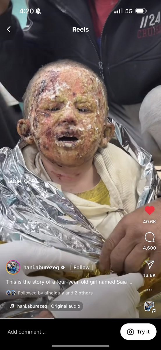 @RichardHanania We’re against the people who cry out in pain as they use white phosphorus on children