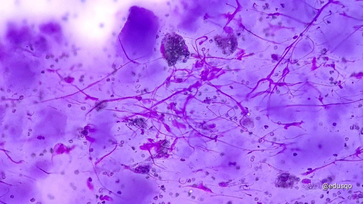 Eduardo Alcaraz, MD PhD tweet media