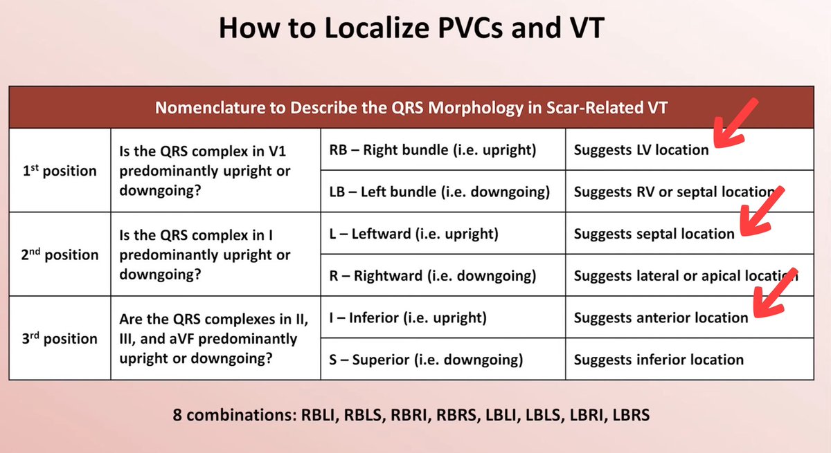Dr.トモ@心電図オタク (@ecgotaku) on Twitter photo <a href="/ecgandrhythmRoe/">Dr. Andreas Roeschl</a> Differentiation of WCT…,
〈Brugada Algorithm〉
・No RS in V1-6
➥VT is likely
〈Vereckei aVR Algorithm〉
・Initial q wave>40 msec
➥VT is likely
+"Positive concordance" in chest leads
▷▷▷VT is likely, I think.
Using this figure, the origin of this VT is "RBLI pattern" <a href="/ecgandrhythmRoe/">Dr. Andreas Roeschl</a> Differentiation of WCT…,
〈Brugada Algorithm〉
・No RS in V1-6
➥VT is likely
〈Vereckei aVR Algorithm〉
・Initial q wave>40 msec
➥VT is likely
+"Positive concordance" in chest leads
▷▷▷VT is likely, I think.
Using this figure, the origin of this VT is "RBLI pattern"