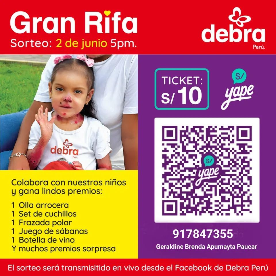RT:
Rifa para ayudar a los pacientes #pieldemariposa en Perú
Número: + 51 - 917847355
Paso 1: Yapea al Qr de la imagen
Paso 2: Toma captura a tu pago
Paso 3: Envía la captura al mismo número que yapeaste
Paso 4: Recibirás la foto de tu ticket
y comparte con tu familia y amigo