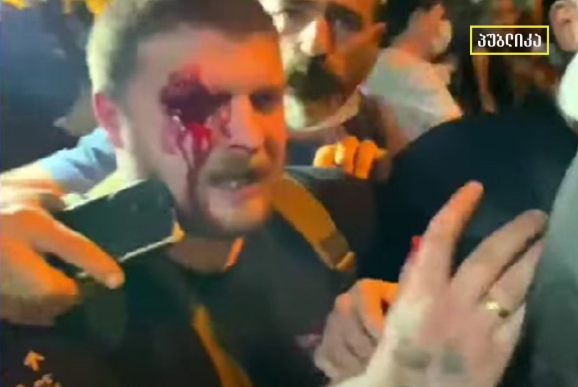 Media reports that an eye of a protester in Tbilisi was injured. He was probably shot a rubber bullet, @RTavisupleba says.