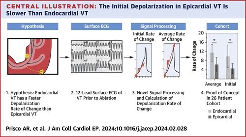 Rate of Change of Initial Intrinsicoid Deflection Predicts Endocardial Versus Epicardial Ventricular Tachycardia | JACC: Clinical Electrophysiology jacc.org/doi/10.1016/j.…