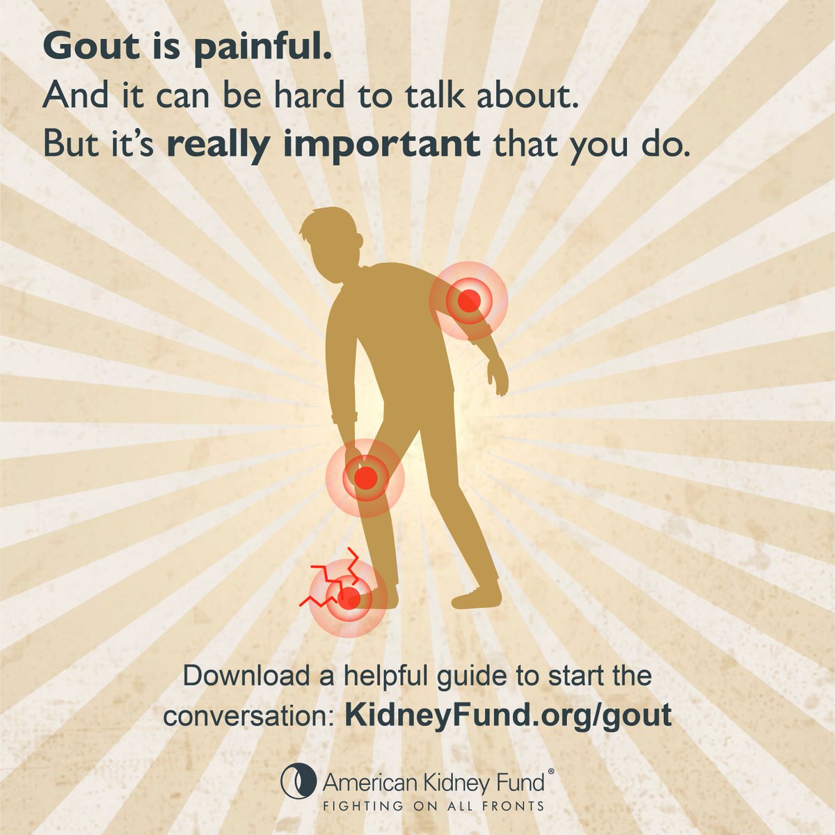Kidney disease is a leading causes of gout, a painful arthritis caused by build up of uric acid in the body. Kidney disease & gout have a mutual relationship - either one could cause the other. Learn about the symptoms of gout & it’s tie to kidney disease: bit.ly/3VDax7N