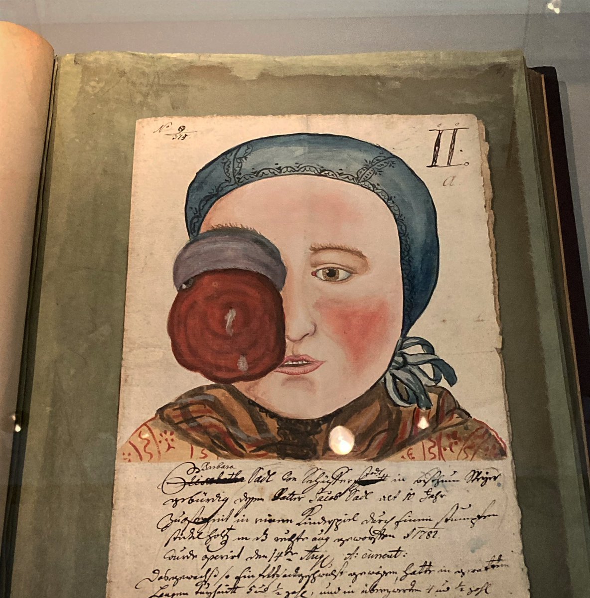 An album of illustrations of eye diseases, used for teaching in the world’s first university eye clinic founded in Vienna in 1812