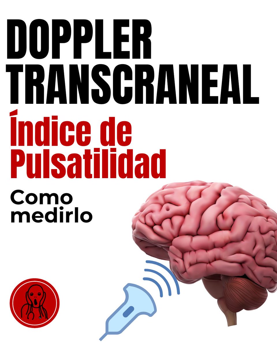 Índice de pulsatilidad de la arteria cerebral media por Doppler transcraneal. Cómo medirlo. Ayúdame a compartir para llegar más lejos, si puedes regálame un comentario muchas gracias!