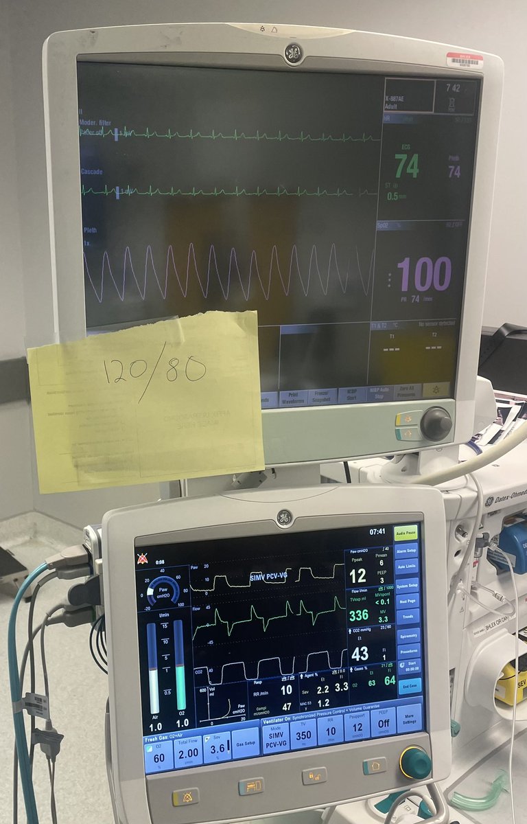 When you ask anesthesia: what’s the blood pressure? #orthotwitter