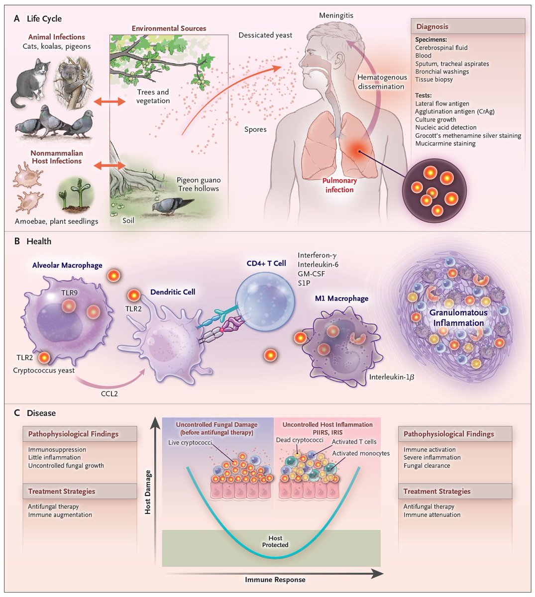 Cryptococcus accounts for up to 180,000 deaths annually and 68% of HIV-related meningitis cases. The authors of a new review discuss diagnostic, preventive, and therapeutic strategies and the pathophysiological role of inflammatory syndromes. Full review: nej.md/44ni39a