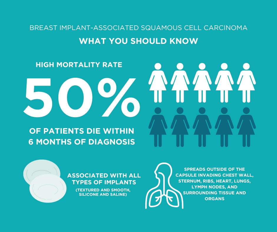 What you should know about Breast Implant-Associated Squamous Cell Carcinoma (BIA-SCC)

As the co-founder of GPAC Global Patient Advocacy Coalition, Robyn Towt directs her advocacy towards promoting awareness of breast implant safety and informed consent: online.fliphtml5.com/nvtea/fjij/#p=…