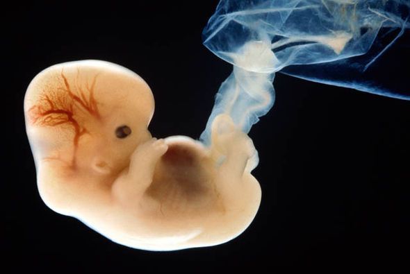 Today, a new Florida law goes into effect that stops abortions on babies at 6 weeks. This is an unborn baby at 6 weeks old. He or she has a beating heart that you can clearly see. We're glad babies like this and older will not be killed in abortions.