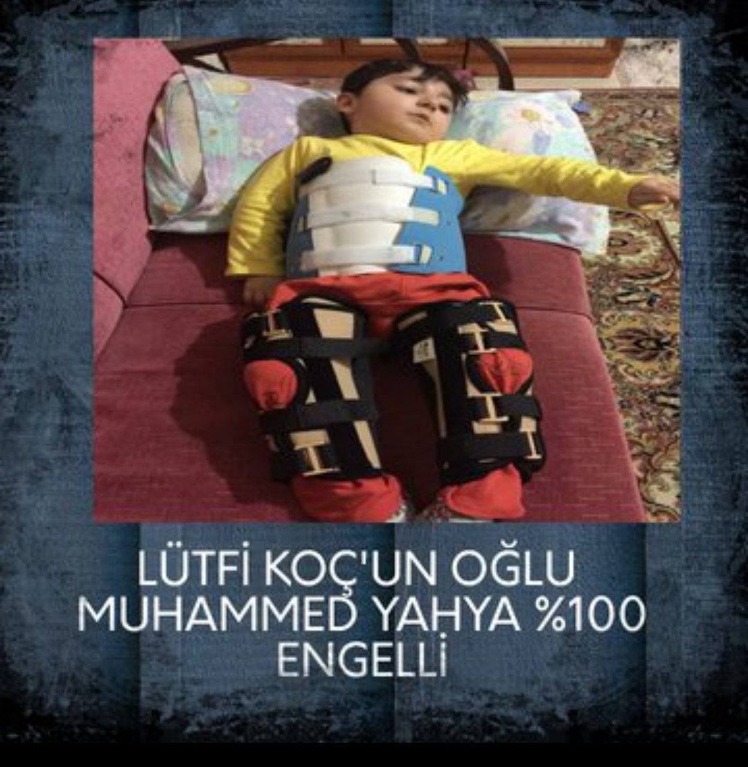Muhammed Yahya is a 100% disabled child. The father, Lütfi Koç, is both in prison and has a very high risk of paralysis because he has two cysts in his brain. Mother Züleyha is very tired now. The blame for these children is very heavy!Muhammed Yahya is a 100% disabled child.