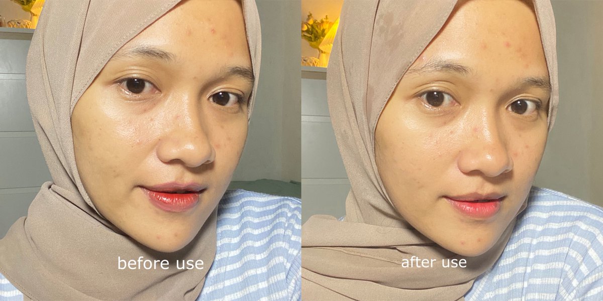 gara-gara kenal exfo serum ini akuu jadi ketagihan pakee😫 aslii sih bangun-bangun wajah jadi keliatan mulus glass skin gituu🤌🏻✨ #racuninskincare #racunskincare