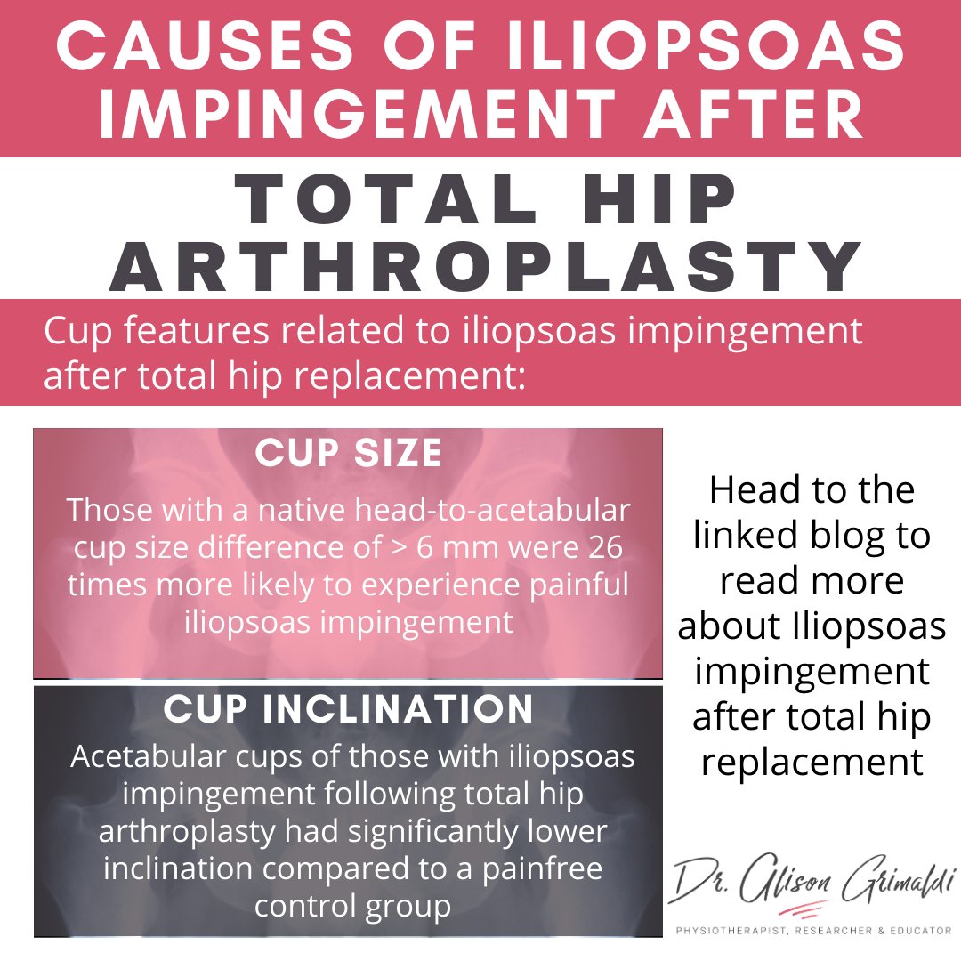 Are you aware that iliopsoas impingement after #THA is a common cause of persistent pain post surgery. Find out what causes it & what the treatment options are: LINK: dralisongrimaldi.com/blog/iliopsoas…