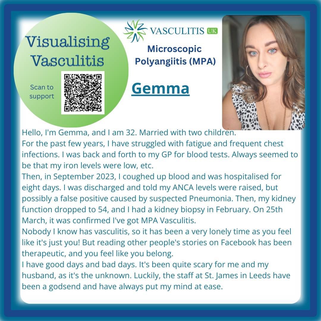 May - Day 2 #vasculitis awareness month. Microscopic Polyangiitis (MPA) is a rare type of vasculitis.Take a moment to read our #patient stories - this is Gemma’s story To donate to #VasculitisUK ‘s campaign this month to support patients and #research - justgiving.com/campaign/visua…