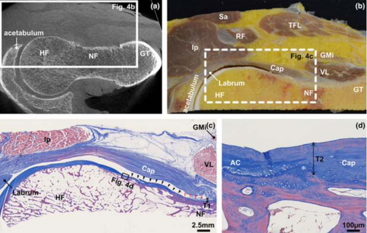 Rheumatology's tweet photo. Capsular attachment on the anterosuperior femoral head–neck junction
https://t.co/PROeiG8Rwh https://t.co/flZNjDQ9h9