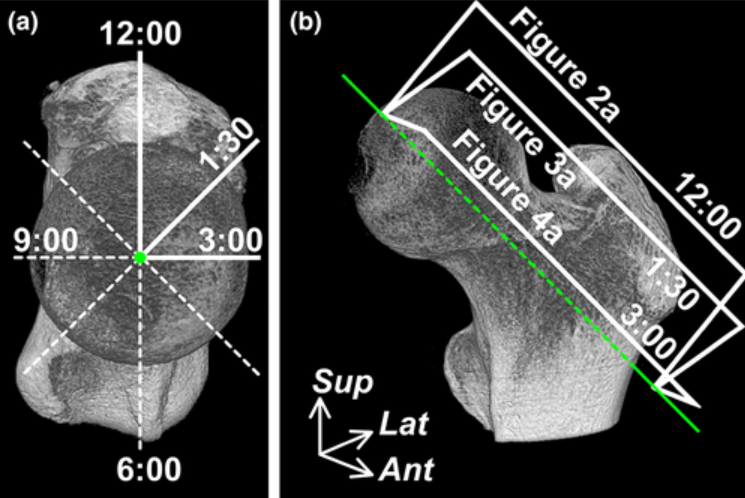 Rheumatology's tweet photo. Capsular attachment on the anterosuperior femoral head–neck junction
https://t.co/PROeiG8Rwh https://t.co/flZNjDQ9h9