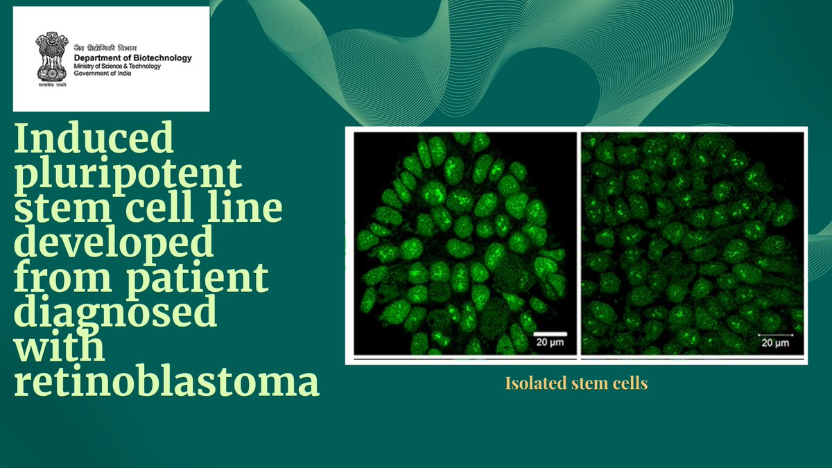 Investigators from <a href="/lvprasadeye/">LVPEI</a> report generation of patient specific induced pluripotent stem cell line (LVPEIi002-A) from a patient diagnosed with retinoblastoma carrying heterozygous mutation in RB1 gene #stemcell 
<a href="/DrJitendraSingh/">Dr Jitendra Singh</a> <a href="/rajesh_gokhale/">Rajesh Gokhale</a>