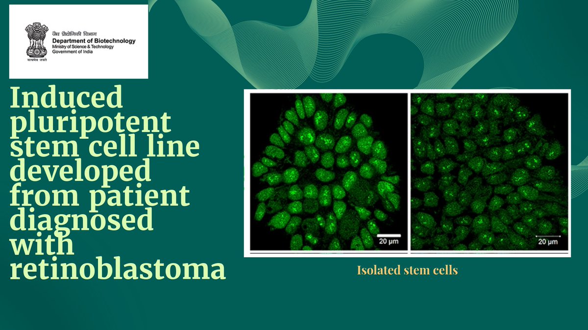 Investigators from @lvprasadeye report generation of patient specific induced pluripotent stem cell line (LVPEIi002-A) from a patient diagnosed with retinoblastoma carrying heterozygous mutation in RB1 gene #stemcell 
@DrJitendraSingh @rajesh_gokhale