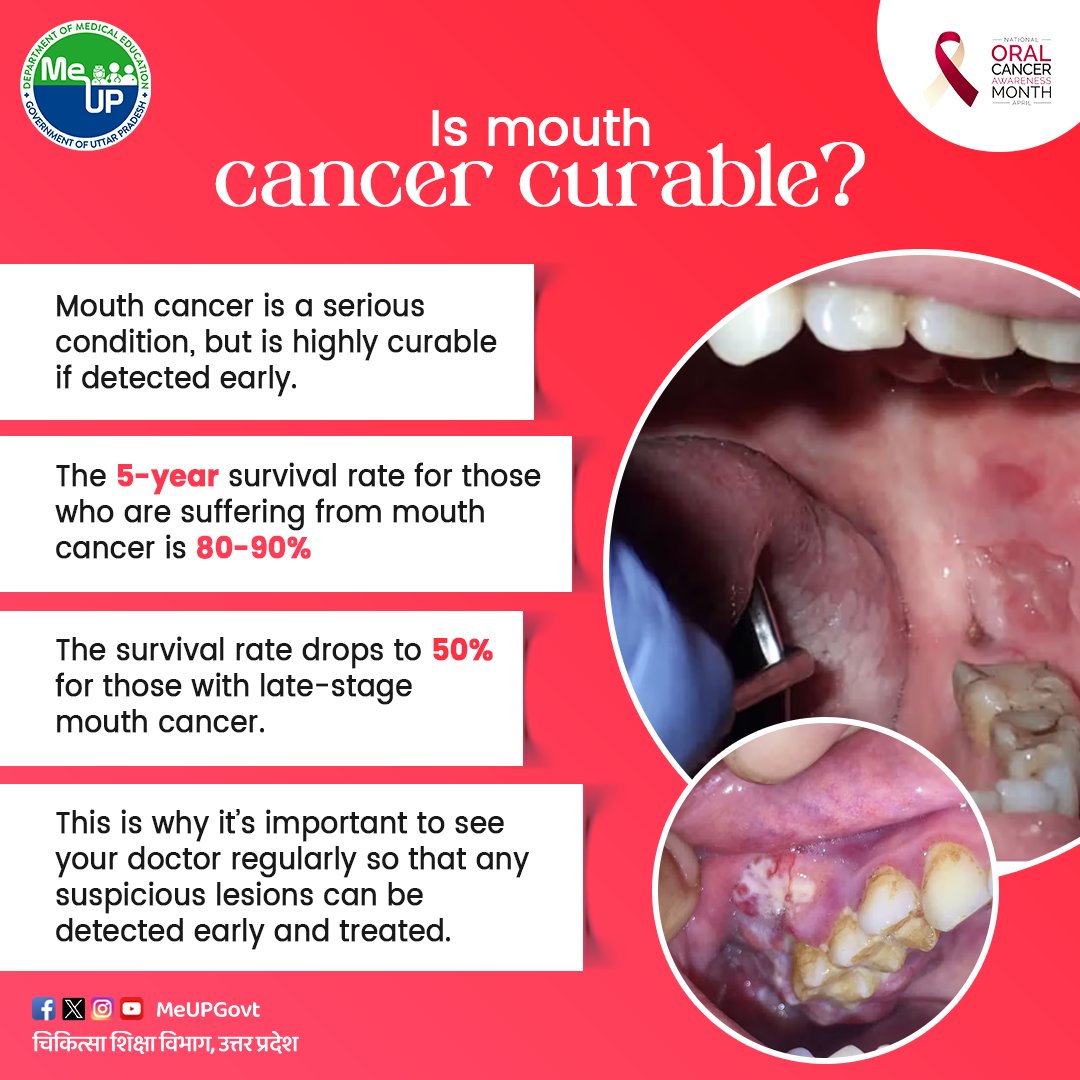 This World Oral Cancer Month protect your smile, know the signs. Early detection saves lives!

#MeUP #MedicalEducation #OralCancer #dental #teeth #OralHealth #OralCare #OralHygiene #SwasthBharat #UttarPradesh