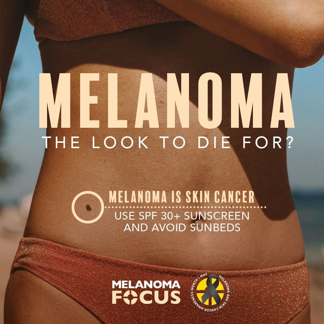 🚨 Announcement 🚨 Our CEO Susanna Daniels will be on Good Morning Britain (@GMB ) at about 06:30am today. She will be discussing our latest research about sunbeds. Tune in to catch Susanna! Learn more 👉 buff.ly/44uLiHi #melanoma #sunbeds @ITV