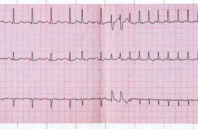 Most of the exams are now asking clinical cases to check the concepts of the students. Why not take the challenge and make it our strength. Do you think you can solve this?🔎

#MedTwitter #MedX #medicine #FMGE #NEETPG @fxgodzeuss @Farmanofficial_