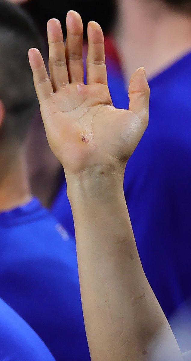 ベンチで手に息を吹きかけるシーンが多い理由 #ohtanishohei