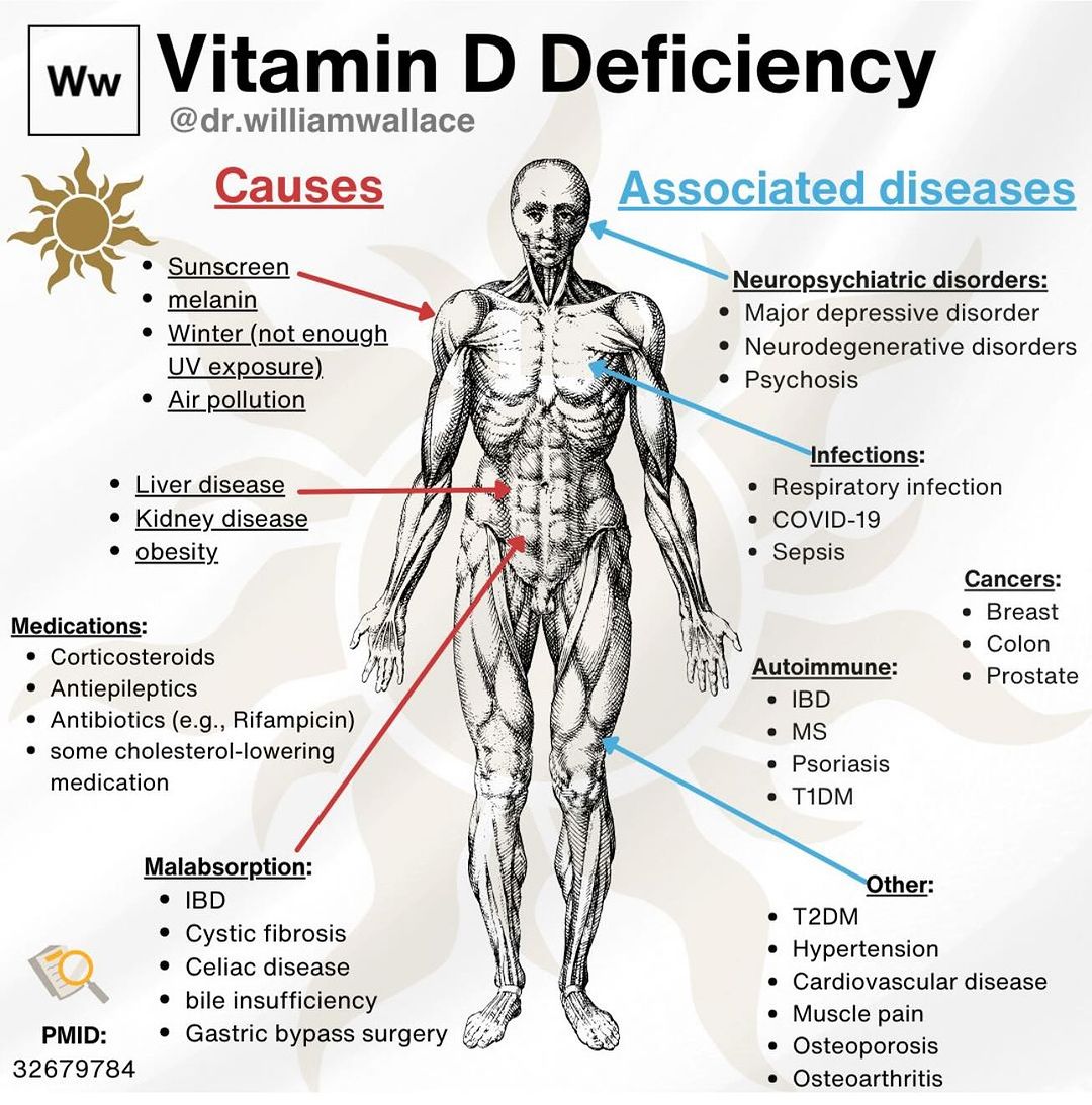 Causes of Vitamin D Deficiency & Associated Diseases ☀️ 🎨 @drwilliamwallac #MedED #VitaminD @HealthcareLdr @FrRonconi @Nicochan33 @Shi4Tech @EvanKirstel @IrmaRaste @Innov_Medicine @sallyeaves @mvollmer1 @gvalan @HeinzVHoenen @fogle_shane @Khulood_Almani @IanLJones98…