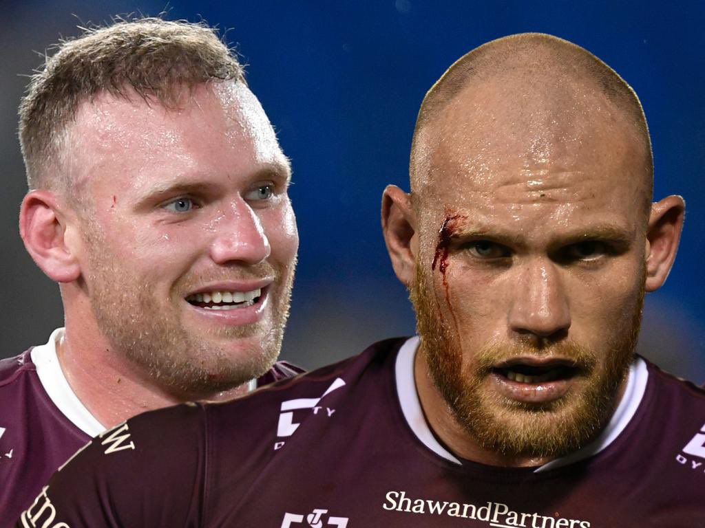 LODGE HAIR TO STAY: Matt Lodge’s new look after flying overseas for a transplant with ‘Turkish Hairlines’. “I’ve taken the tough carry and paved the way for the next generation of young bald men.” couriermail.com.au/sport/nrl/spor…
