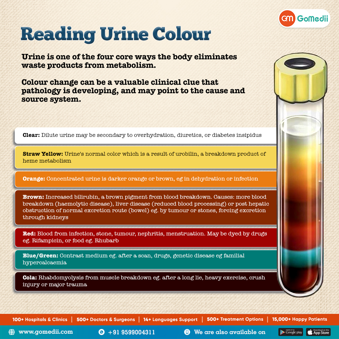 Urine Analysis 🚰✨ Learn how its color can reveal important clues about your health. From hydration levels to potential conditions, understanding urine color is key to staying informed! #UrineAnalysis #HealthAwareness #GoMedii #UrineColour 🌈🔍